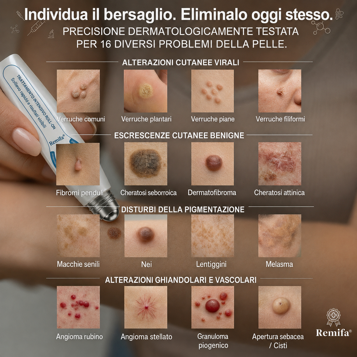 Negozio ufficiale del marchio | (QZBSYZUPSELL)Remifa ® Rimuovi macchie ed escrescenze cutanee in 7 giorni (roller indolore, senza cicatrici dopo l'uso)