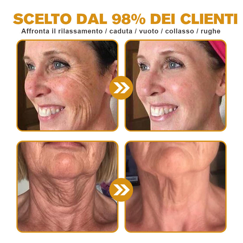 🐝 💧Prodotto e spedito dall'Italia✨ Furzero™ Botox Crema Rimuovi Rughe al Veleno d'Ape - 🔥 ULTIMO GIORNO SCONTO DEL 70%