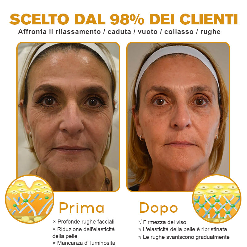 🐝 💧Prodotto e spedito dall'Italia✨ Furzero™ Botox Crema Rimuovi Rughe al Veleno d'Ape - 🔥 ULTIMO GIORNO SCONTO DEL 70%