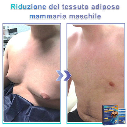 GFOUK® NanoMedix Patch Ginecomastia - Azione Brucia Grassi e Tonificante