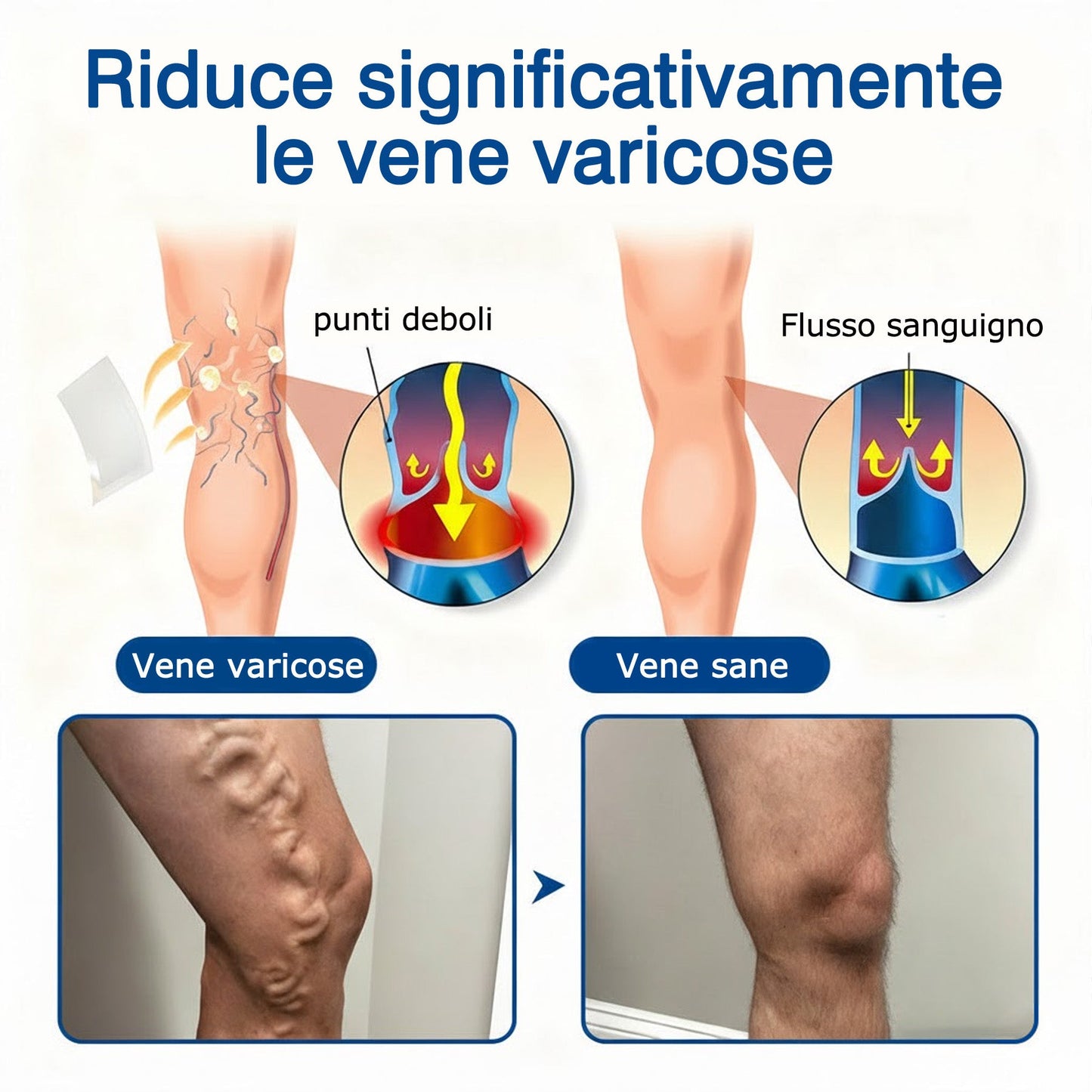 🇮🇹👨‍⚕️💝GFOUK® VeinTarget Microneedle Patch⚡Sollievo immediato, risultati a lungo termine