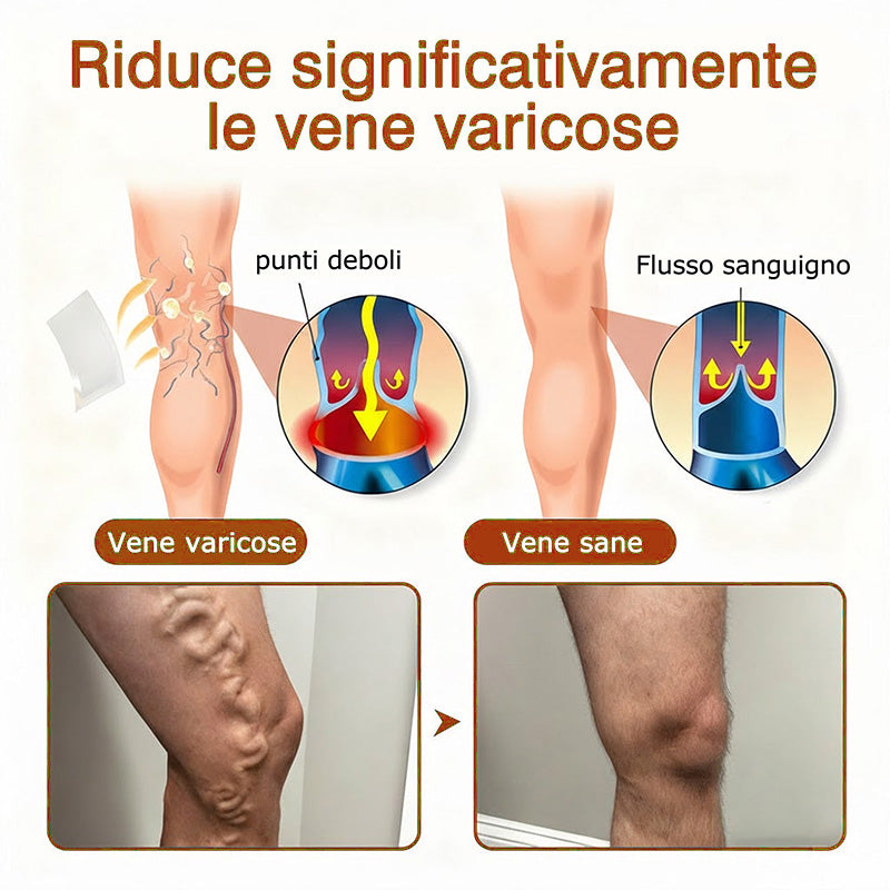 🇮🇹🔥🔥Zvoevo® Cerotto con Microaghi Rilassante Venoso⚡Sollievo immediato, risultati a lungo termine