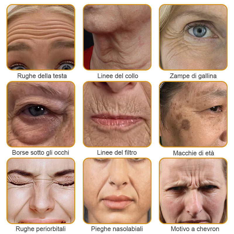 🐝 💧Prodotto e spedito dall'Italia✨ Furzero™ Botox Crema Rimuovi Rughe al Veleno d'Ape - 🔥 ULTIMO GIORNO SCONTO DEL 70%