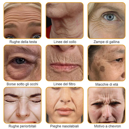 🐝 💧Prodotto e spedito dall'Italia✨ Furzero™ Botox Crema Rimuovi Rughe al Veleno d'Ape - 🔥 ULTIMO GIORNO SCONTO DEL 70%