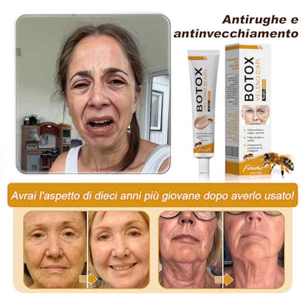 🐝 💧Prodotto e spedito dall'Italia✨ Furzero™ Botox Crema Rimuovi Rughe al Veleno d'Ape - 🔥 ULTIMO GIORNO SCONTO DEL 70%